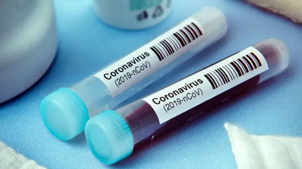 قیمت تست کرونا در آزمایشگاه خصوصی و دولتی 