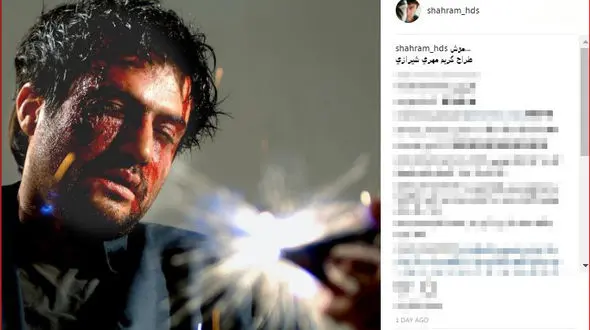 بازیگر معروف تا مرز مرگ رفت + عکس