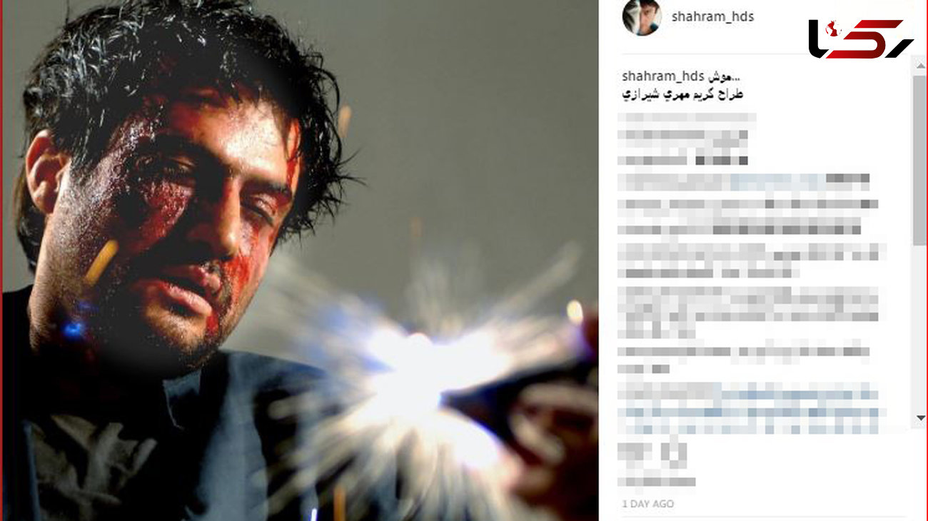 بازیگر معروف تا مرز مرگ رفت + عکس
