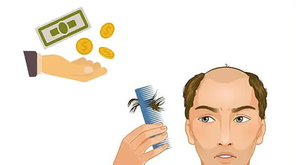 وام کاشت مو چه وامی است؟ + جدول