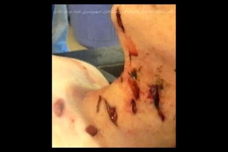 تروریست‌ها هیچ رحمی به مردم عادی نکردند