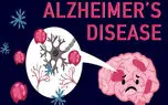 آلزایمر چیست؟ / 6 جدول مهم درباره آلزایمر