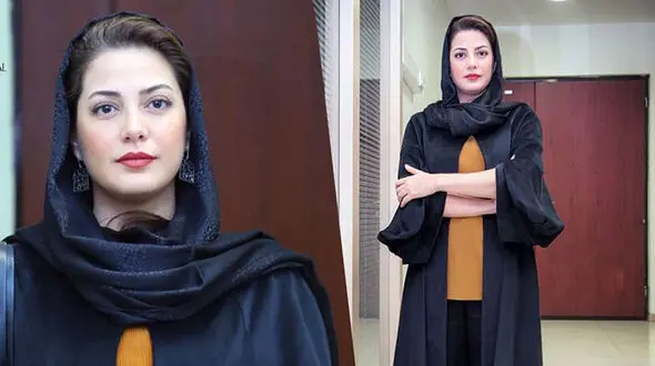 عکسی باورنکردنی از طناز طباطبایی قبل عمل زیبایی