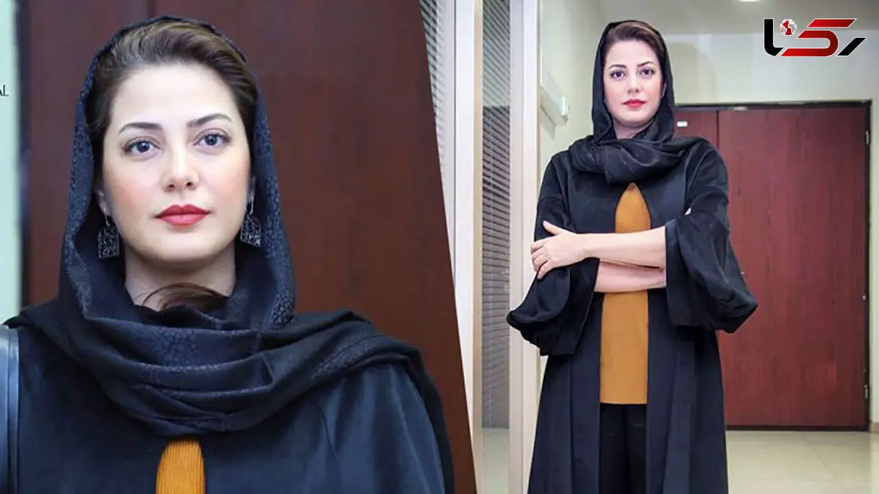 عکسی باورنکردنی از طناز طباطبایی قبل عمل زیبایی