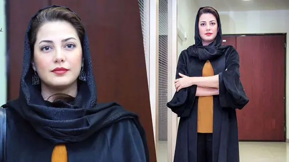 عکسی باورنکردنی از طناز طباطبایی قبل عمل زیبایی