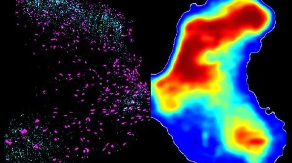 درمان نخاع آسیب دیده با ژن درمانی