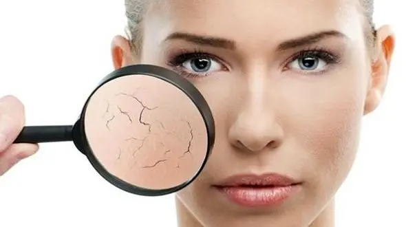 مقابله با خشکی پوست در هوای سرد