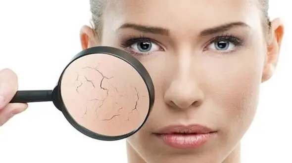 مقابله با خشکی پوست در هوای سرد