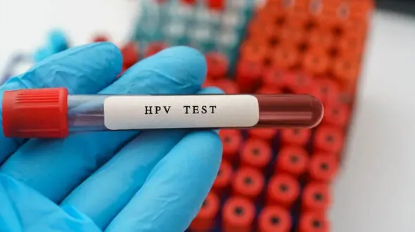 زگیل تناسلی؛ بیماری خاموش اما شایع /80 درصد مردم جهان حداقل یک نوع از ویروس HPV را تجربه می کنند