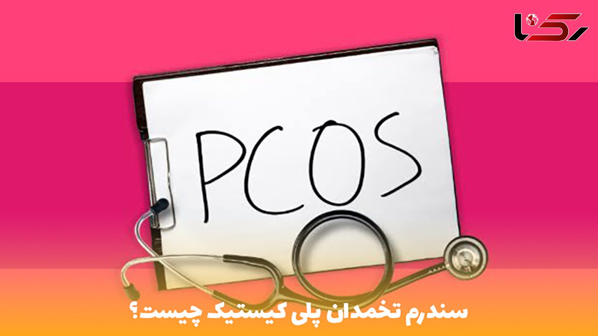 pco چیست؟ + راه های درمان