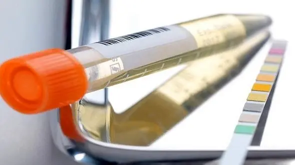 دلایل ابتلای به عفونت ادراری