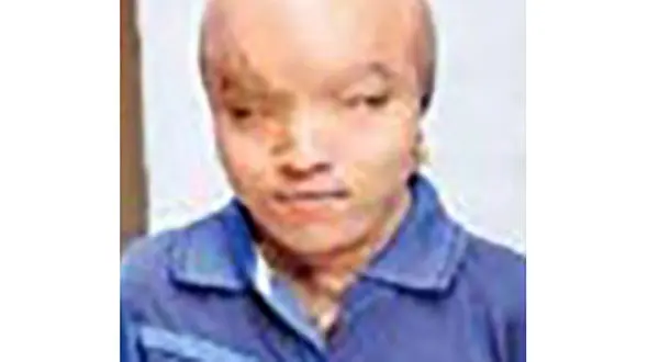 عمل زیبایی پسر عجیب و غریب برای ازدواج با دختر زیبا + عکس