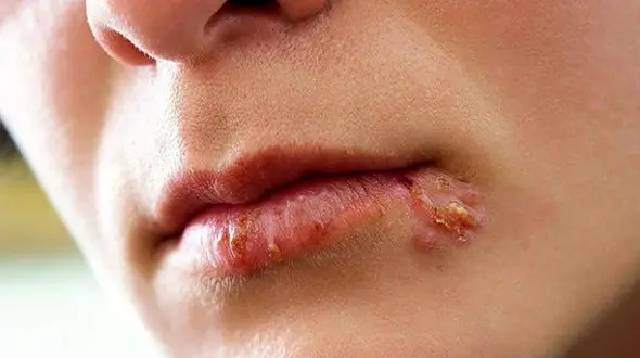 کور شدن زنان ایرانی به خاطر استفاده از مدادهای چشم تقلبی / سونامی سرطان پوست و مو با لوازم آرایشی قاچاق در راه ایران است ! + فیلم