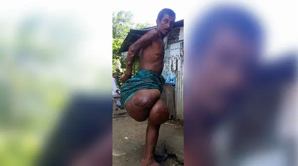 پای گنده یک مرد چه رازی دارد؟+فیلم و عکس