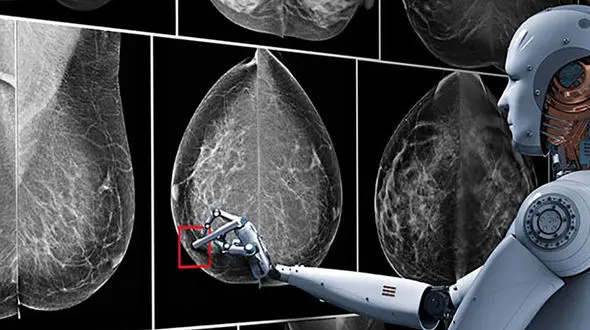 تشخیص سرطان با هوش مصنوعی؛ ماجرای نجات جان یک نفر توسط ChatGPT