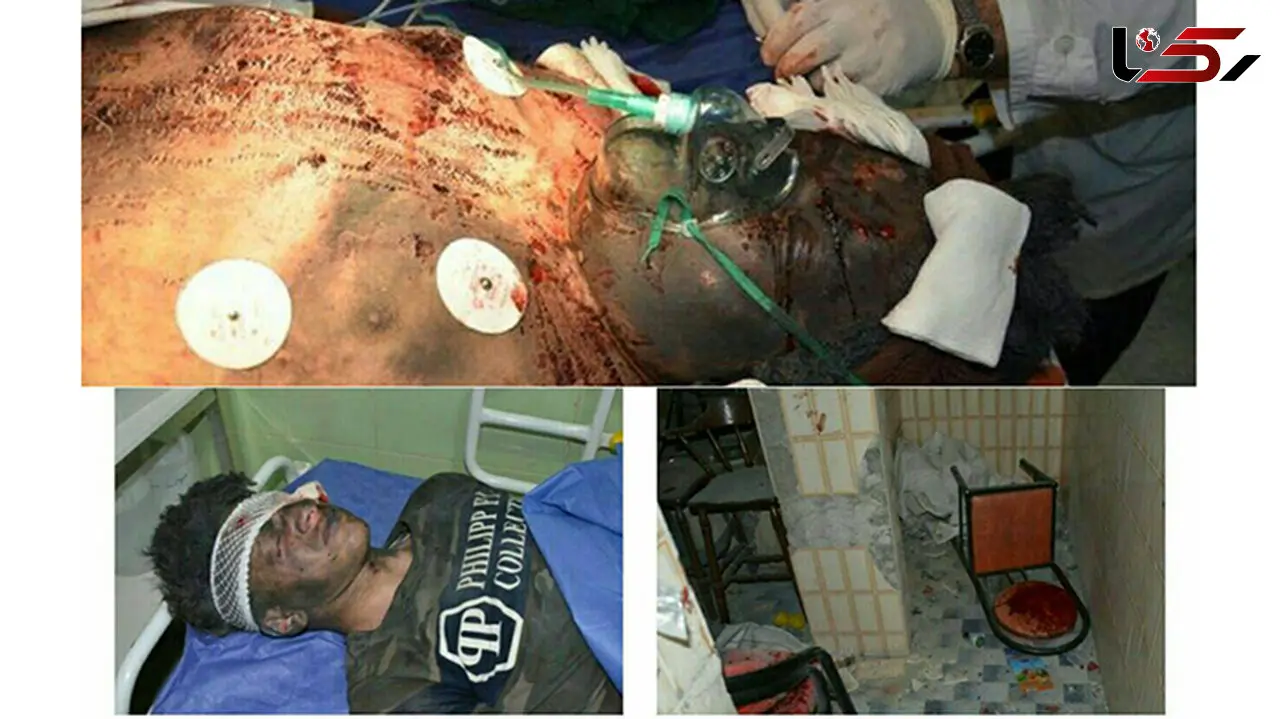 تصاویر عبرت انگیز از زخمی شدن 3 نفر در اردبیل بر اثر انفجار مواد محترقه +عکس