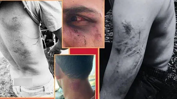 ماجرای حمله به گردشگران در اوپرت با سلاح گرم و شوکر چیست؟  + عکس