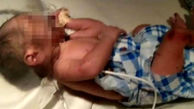مورچه ها گوشت بدن نوزاد دختری که در میان زباله ها رها شده بود را خوردند/ والدین هندی پسر می خواستند!+عکس