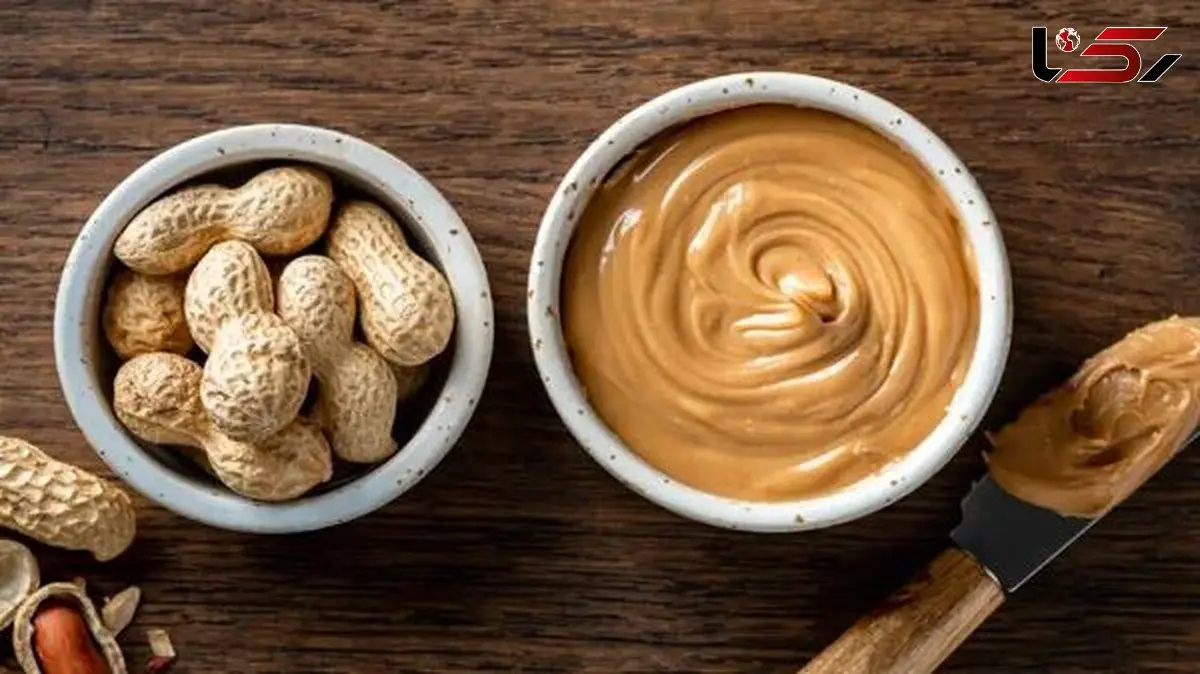 درمان آلرژی بادام زمینی تنها با یک راز ساده