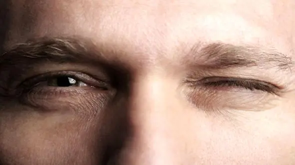 علت پرش پلک چشم و درمان خانگی آن + فیلم