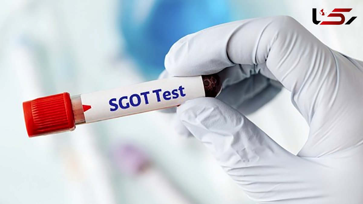  s.g.o.t در آزمایش خون چیست؟ + مقدار هزینه و جدول 