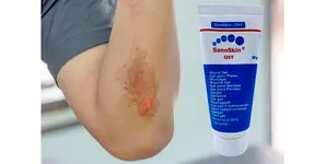 معجزه ژل جدید و عجیب برای درمان زخم بستر 