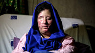 سهیلا جورکش قربانی اسیدپاشی جنجالی  اصفهان نور را می‌بیند / هنوز پولی از ایران نرسیده است