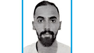 فرار دندان‌پزشک قلابی مشهد پس از پلمب مغازه غیرمجاز
