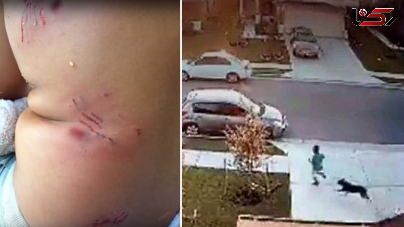 حمله خونبار سگ درنده به کودک ۷ ساله+فیلم و عکس
