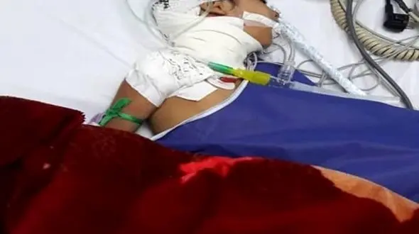 بلای وحشتناکی که 2 سگ وحشی بر سر دختر بچه خرمشهری آوردند+ عکس