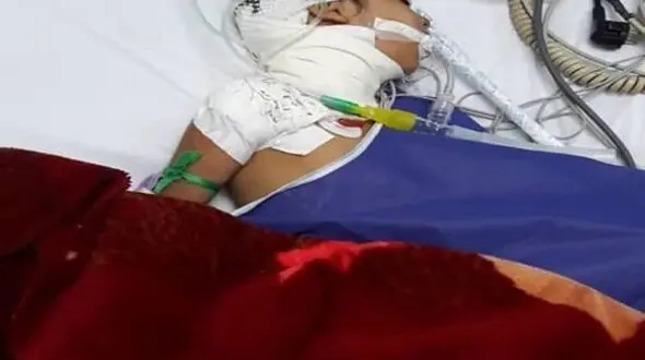 بلای وحشتناکی که 2 سگ وحشی بر سر دختر بچه خرمشهری آوردند+ عکس