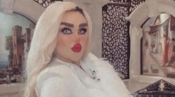 خانم باربی عراقی با ۴۳ عمل زیبایی زامبی شد ! + عکس حیرت انگیز