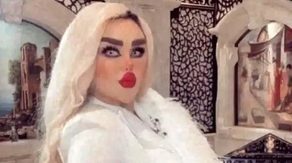 خانم باربی عراقی با ۴۳ عمل زیبایی زامبی شد ! + عکس حیرت انگیز