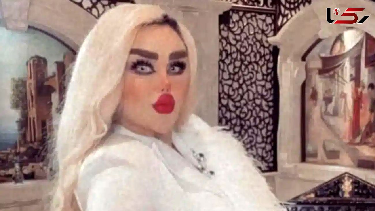 باربی دوشیزه عراقی با 43 عمل زیبایی زامبی شد! + عکس شگفت انگیز