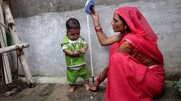 ماجرای عجیب مرد ۶۰ سانتیمتری!