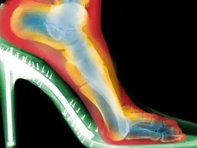حقایقی جالب درباره تاثیر کفش پاشنه‌ بلند بر شکل پا