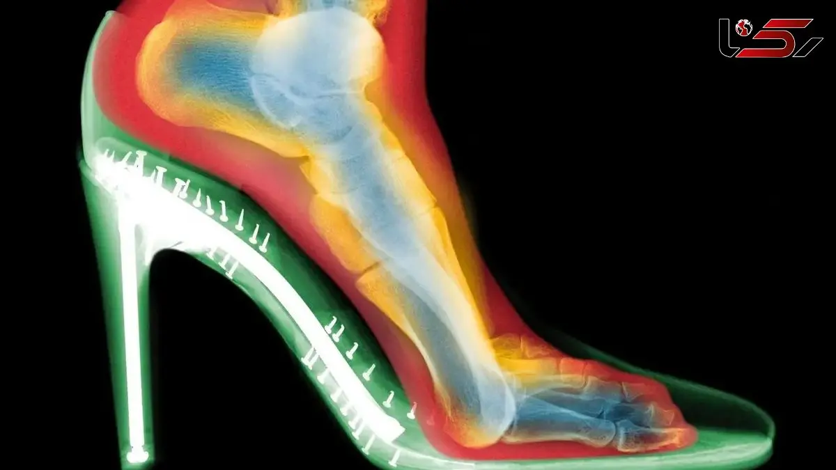 حقایقی جالب درباره تاثیر کفش پاشنه‌ بلند بر شکل پا