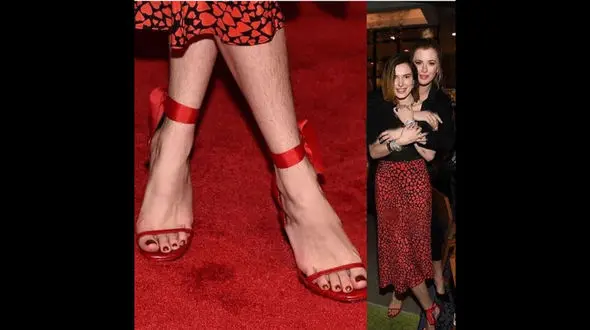 بدن پر موی خانم بازیگر جنجال به پا کرد+عکس