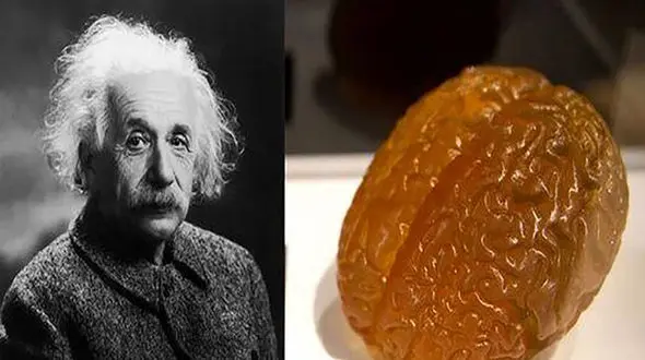مغز انیشتین کجاست؟ + عکس
