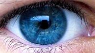 این لکه ها در چشم نشانه ابتلای به آلزایمر است