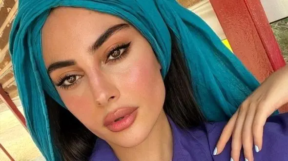 عکس مبتذل ترلان پروانه کار دستش داد / تغییر چهره خانم بازیگر جوان بعد از تزریق لب 