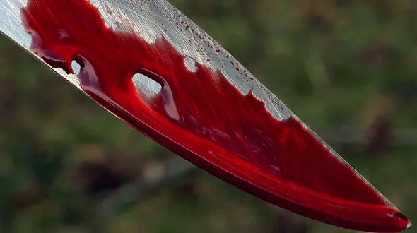 قطع دست جوان تهرانی با قمه اوباش در پارک شاهد! / خیای فجیع بود!