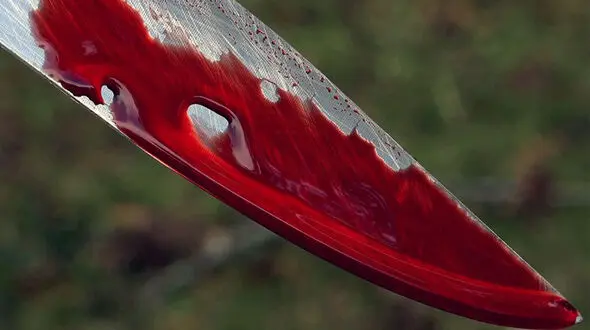 قطع دست جوان تهرانی با قمه اوباش در پارک شاهد! / خیای فجیع بود!