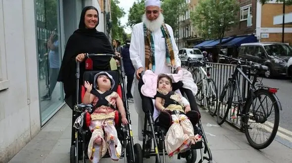 جداسازی دوقلوهای پاکستانی پس از ۵۰ ساعت جراحی