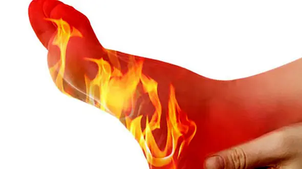 درمان داغی کف پا