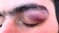 حمله با چاقو به چشمان یک پزشک در بندرعباس + عکس تلخ