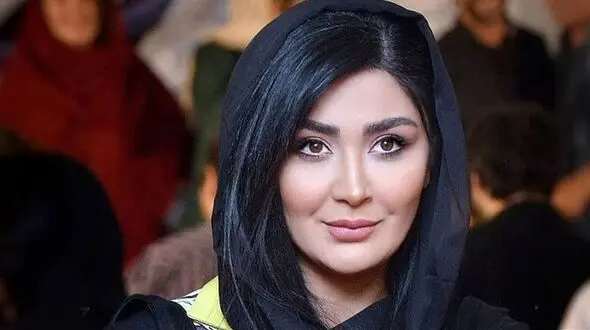 مریم معصومی اسمش سگ گرونش رو آقای سیمبا معصومی گذاشته / براش پیج اینستاگرام زده تازه میخواد دندون‌هاشم لمینیت کنه