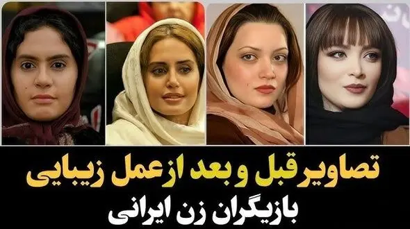 فیلم / تعییر چهره باورنکردنی و حیرت انگیز خانم بازیگران پس از دستکاری صورتشان / از الناز حبیبی تا طناز طباطبایی از سحر دولتشاهی تا نیوشا ضیغمی و ...