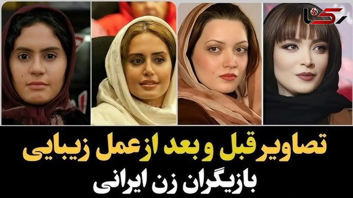 فیلم / تعییر چهره باورنکردنی و حیرت انگیز خانم بازیگران پس از دستکاری صورتشان / از الناز حبیبی تا طناز طباطبایی از سحر دولتشاهی تا نیوشا ضیغمی و ...