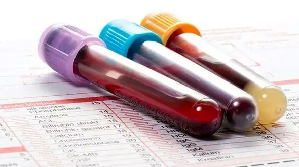 غربالگری «پویش ملی سلامت» از ۱۵ میلیون نفر گذشت